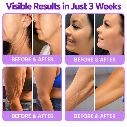 TopSpire®🎗️ PDRN Multi-Peptide Firming Body Cream | Anti-Aging Skincare, Deep Hydration, Firming & Lifting Care for Smoother, More Radiant-Looking Skin-c