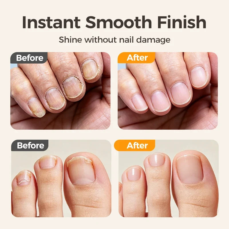 TopSpire®🔥Last Day 50% OFF -✂️ 2-in-1 Smart Electric Nail Clipper & Polisher – Anti-Pinch Safety & LED Light 💅