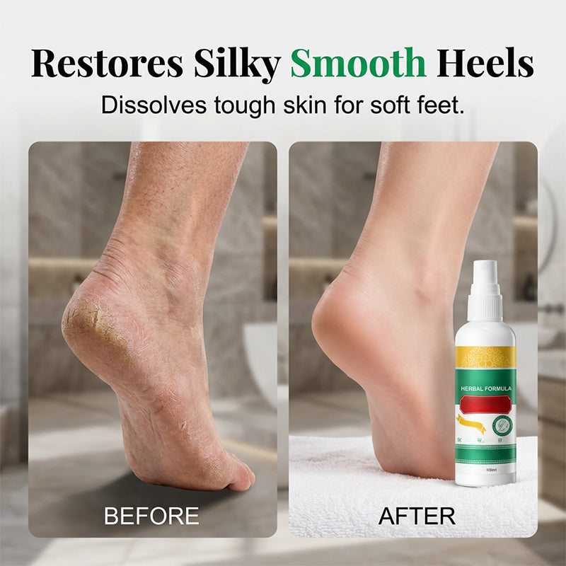 TopSpire®🌿 Refreshing Foot Spray – Fresh, Cool & Comfortable Feet
